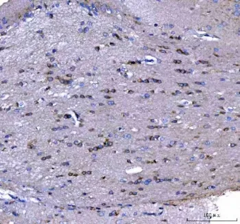 MAP6D1 Antibody / MAP6 domain-containing protein 1 - image 1
