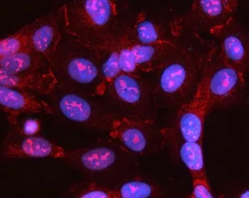 MYL5 Antibody / Myosin light chain 5 - image 1