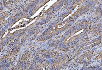 PROSER3 Antibody / Proline and serine-rich protein 3 - image 1