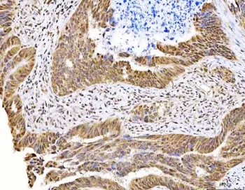 MAGED4 Antibody / Melanoma-associated antigen D4 - image 1