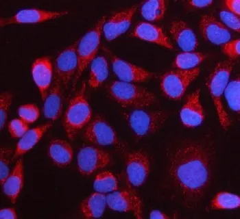 NTN3 Antibody / Netrin 3 - image 1