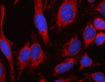 MSLNL Antibody / Mesothelin-like protein - image 1