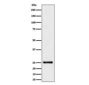 HMGB3 Recombinant Antibody / HMG4 - image 1