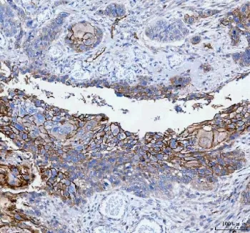 PALM Antibody / Paralemmin - image 1