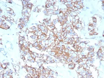 HER2 Recombinant Antibody / ErbB2 - image 1