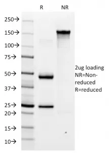 Helicobacter pylori Antibody - image 1