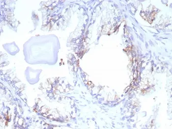 MRP4 Antibody / ABCC4 - image 1