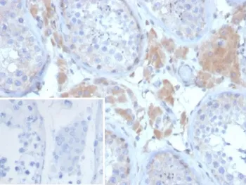 GDF9 Antibody / Growth Differentiation Factor 9 - image 1