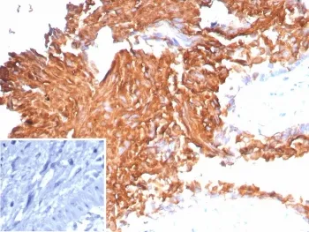 Uroplakin 1B Recombinant Antibody / UPK1B - image 1