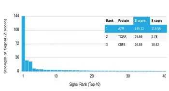 A2M Antibody / Alpha-2-Macroglobulin - image 1