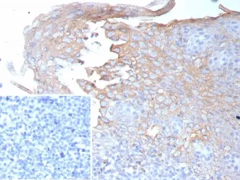 Interferon gamma Antibody - image 1