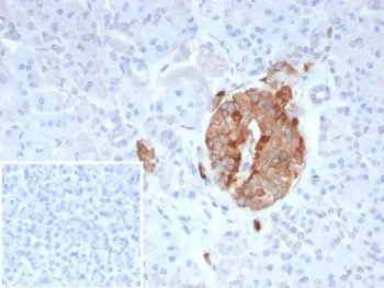 Collagen IV Recombinant Antibody / COL4A3 - image 1