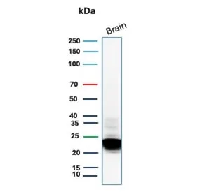MBP Recombinant Antibody / Myelin Basic Protein - image 1