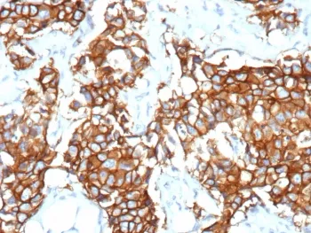 HER2 Recombinant Antibody / ErbB2 - image 1