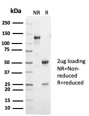 p53 Recombinant Antibody / TP53 - image 1