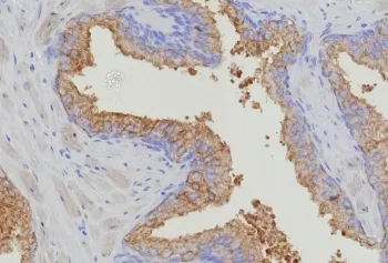 Thymidylate Synthase Recombinant Antibody - image 1