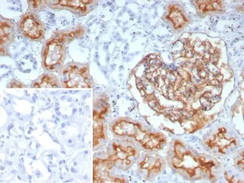 CD10 Recombinant Antibody / Neprilysin - image 1