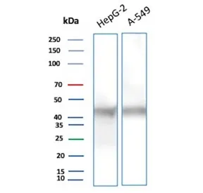 NSE Antibody / Neuron Specific Enolase - image 1