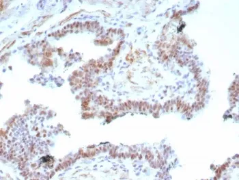 AR-V7 Recombinant Antibody / Androgen Receptor - image 1