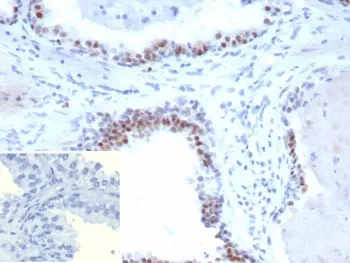 Androgen Receptor V7 Recombinant Antibody - image 1