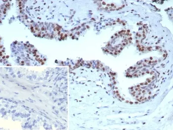 AR-V7 Recombinant Antibody / Androgen Receptor - image 1