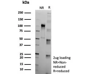 Clusterin Recombinant Antibody / Apolipoprotein J / APO-J - image 1