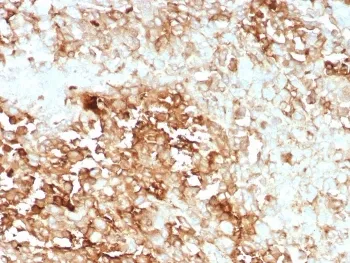 Clusterin Recombinant Antibody / Apolipoprotein J / APO-J - image 1