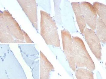 MYH7 Antibody / Myosin 7 - image 1
