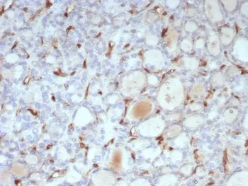 Thyroid Stimulating Hormone Receptor / TSHR Recombinant Antibody (beta chain) - image 1