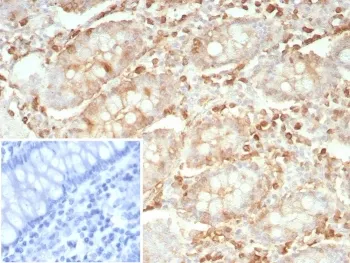 STMN1 Recombinant Antibody / Stathmin 1 - image 1