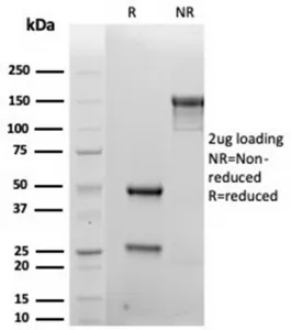 SDC1 Recombinant Antibody / Syndecan-1 - image 1