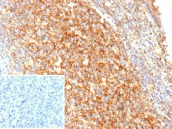 CD21 Recombinant Antibody - image 1