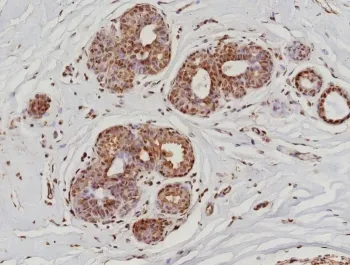 POLR2A Recombinant Antibody / RNA polymerase II CTD Repeat YSPTSPS / Phosphorylated Serine 5 - image 1