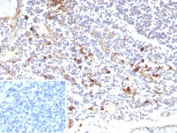IL3RA Recombinant Antibody / CD123 - image 1