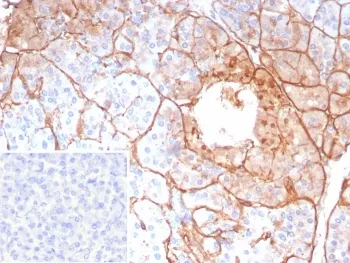 Collagen IV Recombinant Antibody / COL4A5 - image 1