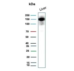 CPS1 Recombinant Antibody / Carbamoyl phosphate synthetase 1 - image 1
