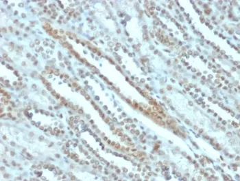 STAT3 Antibody - image 1