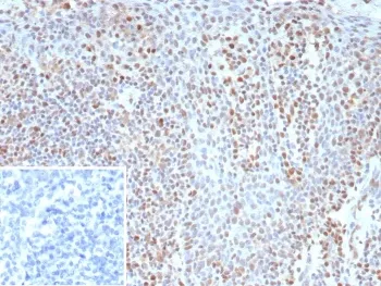 Bcl6 Recombinant Antibody - image 1