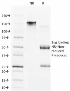 CDX1 Antibody / Caudal Type Homeobox 1 - image 1