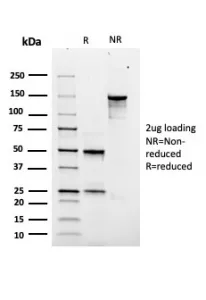 SOX9 Recombinant Antibody - image 1