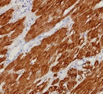 Calponin 1 Recombinant Antibody - image 1