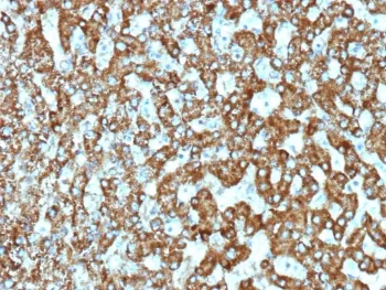EPHB4 Recombinant Antibody / EPH Receptor B4 - image 1