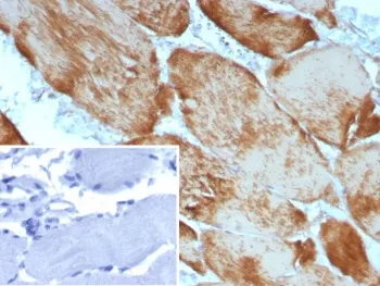 Alpha Actin Recombinant Antibody / ACTA1 (skeletal muscle) - image 1