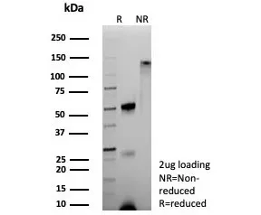 Hemoglobin subunit alpha Recombinant Antibody / HBA - image 1