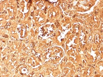 Hemoglobin subunit alpha Recombinant Antibody / HBA - image 1