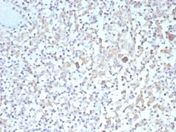 Bcl-X Recombinant Antibody - image 1