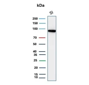 CDH17 Recombinant Antibody / Cadherin 17 - image 1