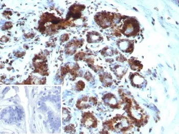 BAP1 Recombinant Antibody / BRCA1-Associated Protein 1 - image 1