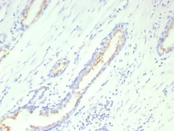 Prostein Recombinant Antibody / SLC45A3 - image 1