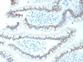 CDX2 Recombinant Antibody - image 1